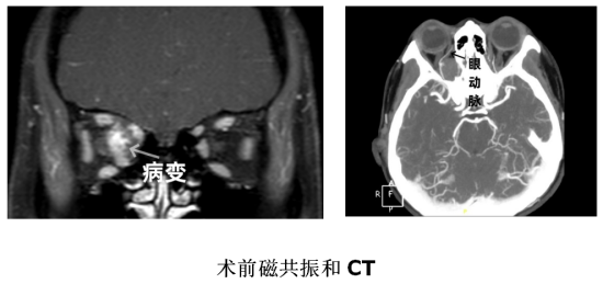 牙周病患注意，脑卒中风险显著上升！你的生活态度决定生命质量。